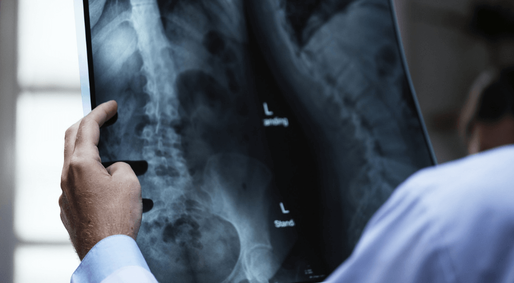 Catastrophic injury attorney