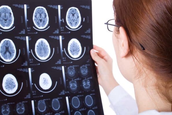 support-brain-injury-16.3.31-595xh support-brain-injury-16.3.31-595xh